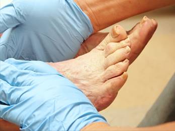 Diabetic Foot Care in the Broward County, FL: Tamarac (Margate, Coral Springs, Sunrise, Lauderdale Lakes, Wilton Manors, Coconut Creek, Lauderhill, Parkland, Oakland Park, Plantation, Pompano Beach) and Pembroke Pines (Miramar, Weston, Davie, Dania Beach, Hallandale Beach, Hollywood), and Miami-Dade County, FL: Miami Gardens, Opa-locka, Aventura, Hialeah, Country Club, Golden Glades areas